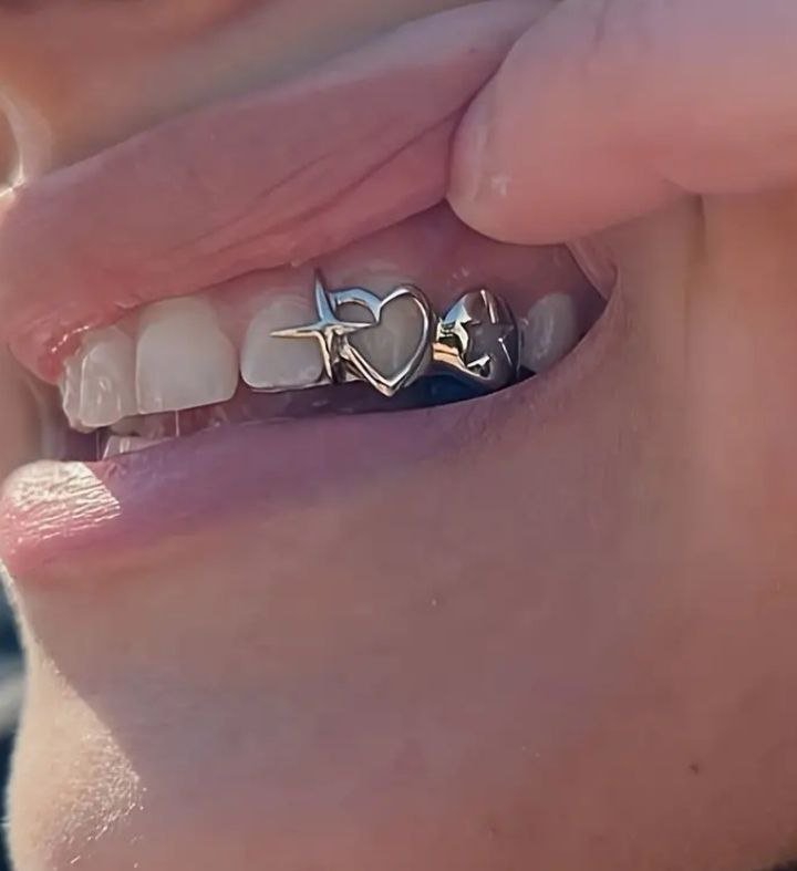 Tooth gems 1 Tooth gems